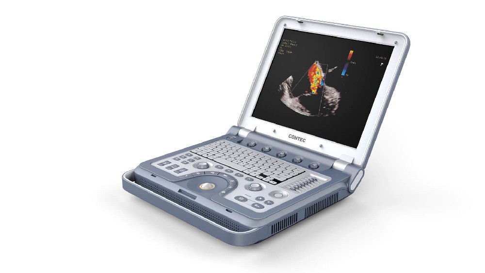 Laptop Portable Color Doppler Ultrasound